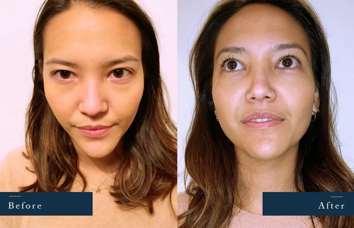 Before and after an LVL lash lift, lashes visibly lifted and curled in the after shot