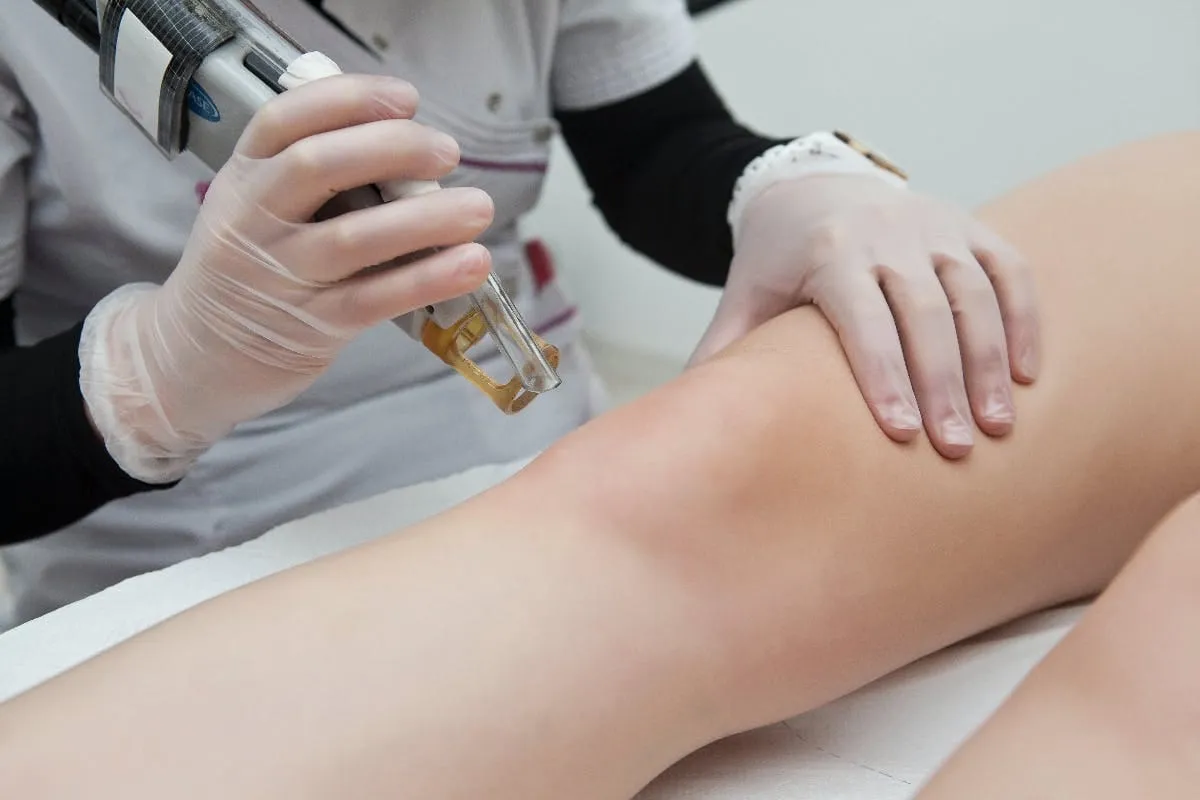 The ultimate guide to laser hair removal
